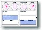 eldoncard blood type test kit