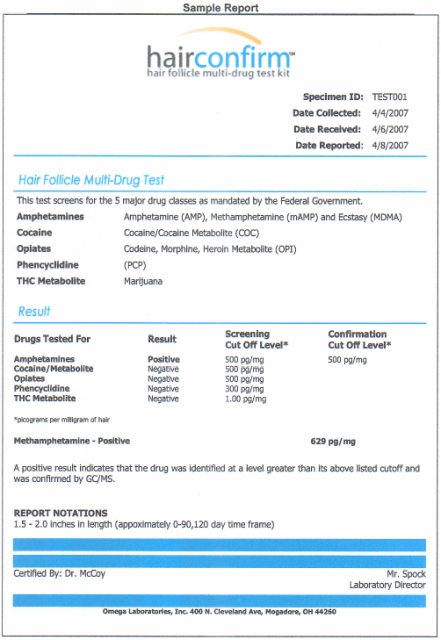 Hair Follicle Drug Test Chart