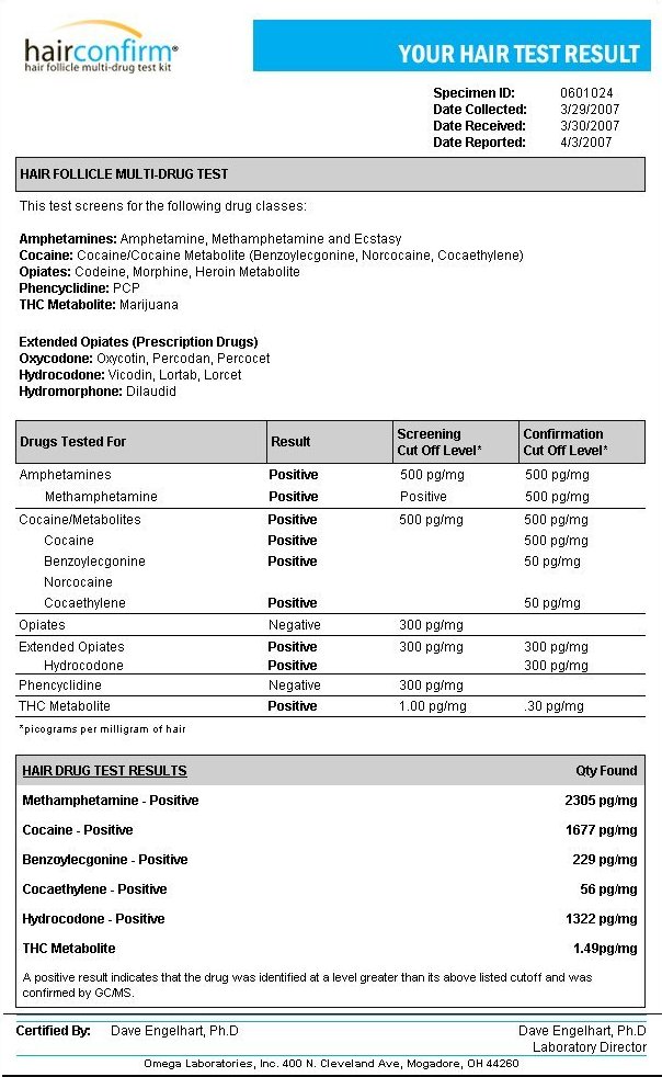 Hair Drug Test Chart