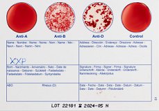 Find Out Your Blood Type With An At Home Blood Type Test (Eldoncard)