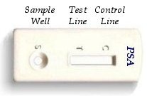 PSA Prostate Cancer Screening Test