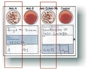 blood type test results card